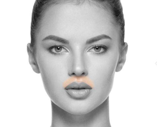 Ladies Upper Lips • Laser Hair Removal