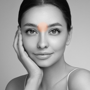 Ladies Unibrows • Laser Hair Removal