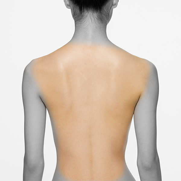 Ladies Full Back & Shoulder • Laser Hair Removal