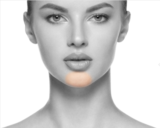 Ladies Chin • Laser Hair Removal