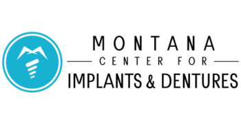 Montana Implants