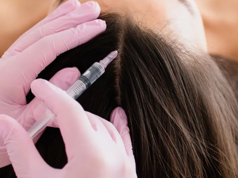 Capillary Treatment with PRP Consultation