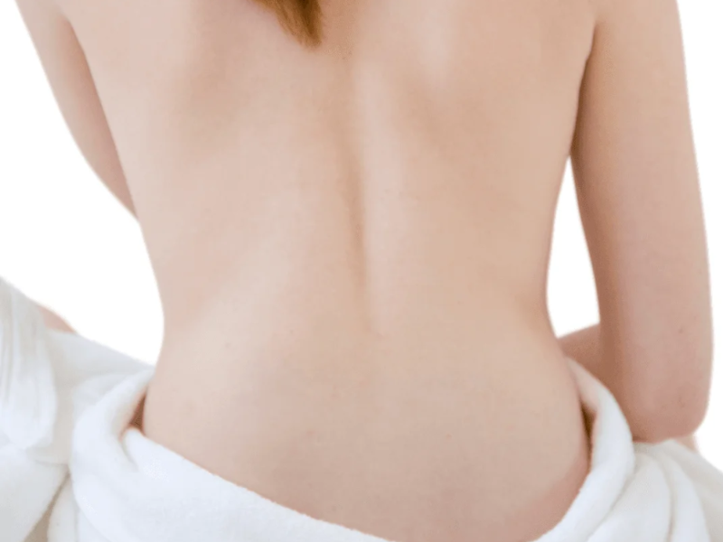 Men Chest Full / Pecho Completo laser hair removal at Barbie Beauty Care