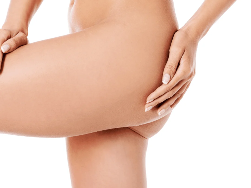 Belly Line / Línea del Ombligo laser hair removal at Barbie Beauty Care