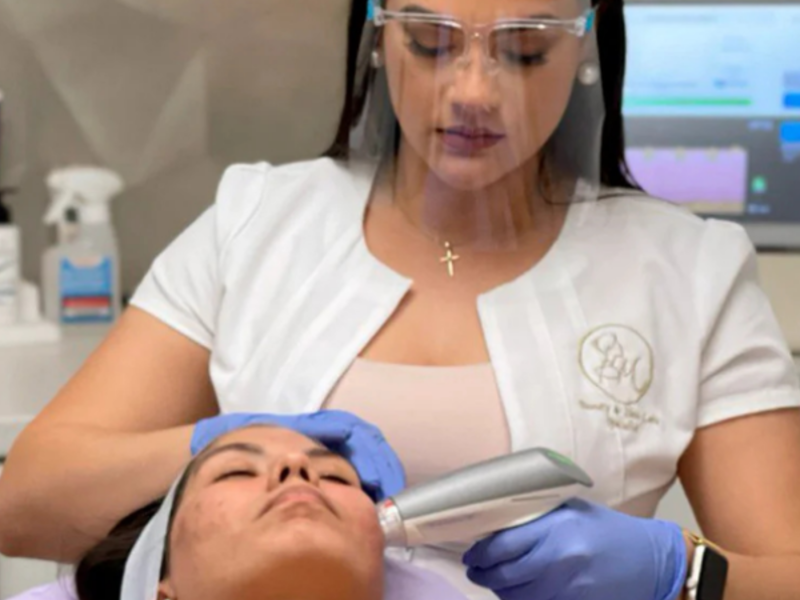 Acne Scar Removal Sublative Consultation