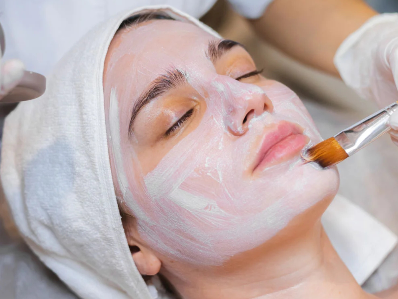 Chemical Peels