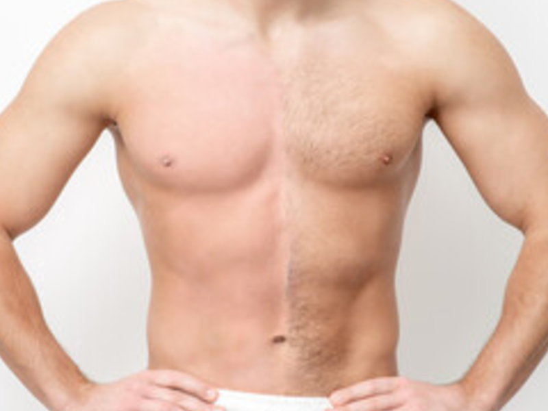 Chest Wax-image