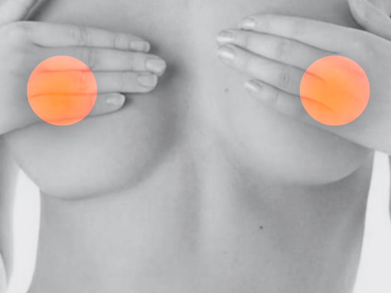 Ladies Nipple • Laser Hair Removal