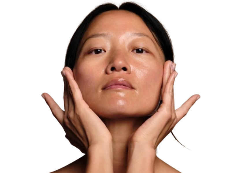 IPL Skin Rejuvenation-image