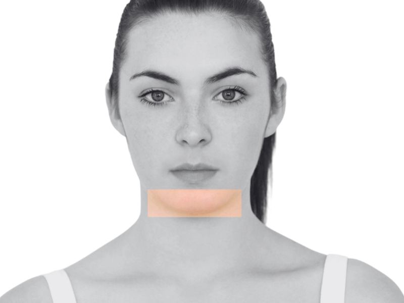 Ladies Chin & Jawline • Laser Hair Removal