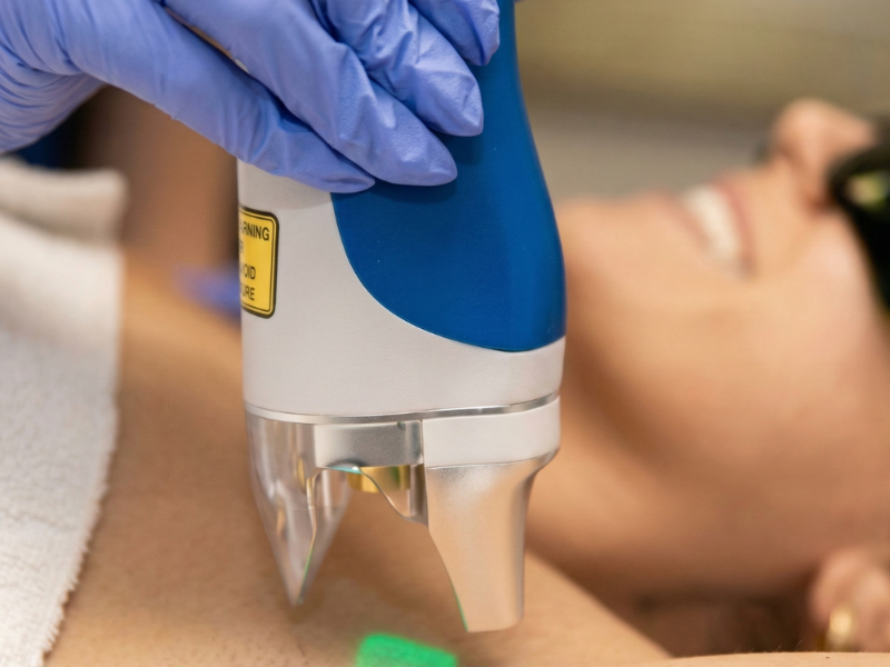 Arms / Brazos laser hair removal at Barbie Beauty Care